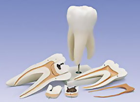 Лечение кариеса и других поражений зуба