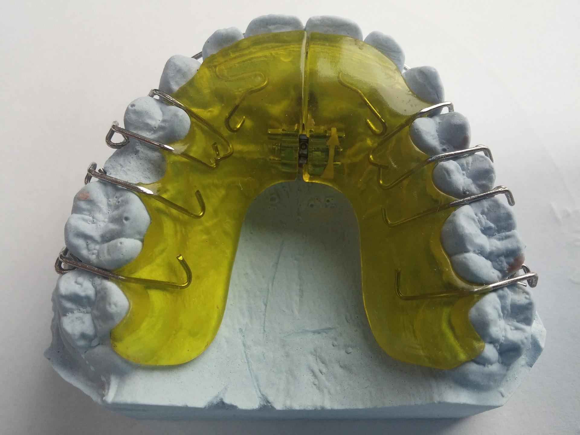 Одночелюстные ортодонтические пластинки 